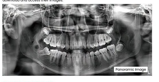 High resolution panoramic radiograph captured with the FinScan F350