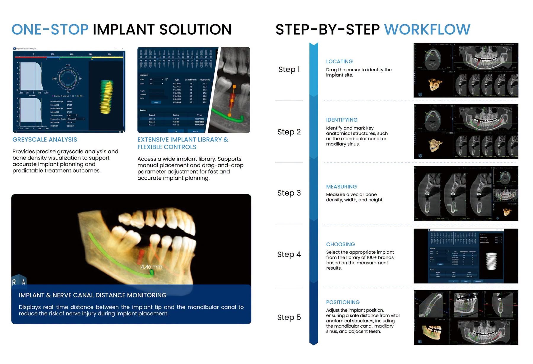 FinScan F350 brochure page 6 — One-stop implant solution and step-by-step workflow